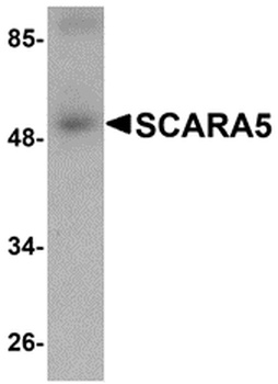 SCARA5 Antibody