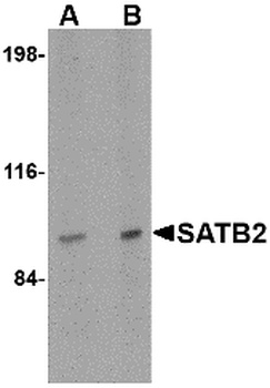 SATB2 Antibody