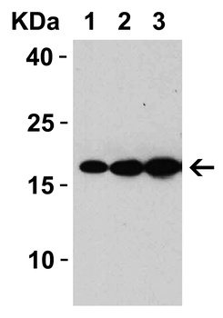 SARS-CoV Matrix Antibody