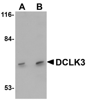 DCLK3 Antibody
