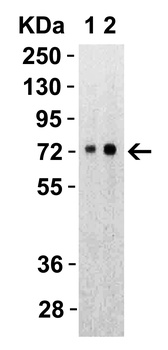 SARS-CoV-2 (COVID-19) Spike S2 Antibody