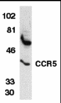 CCR5 Antibody