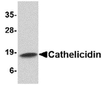 Cathelicidin Antibody