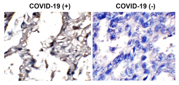 SARS-CoV-2 (COVID-19) Envelope Antibody (biotin)