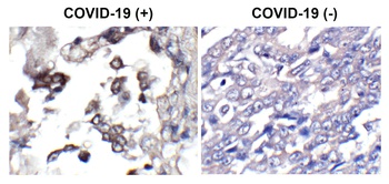 SARS-CoV-2 (COVID-19) Envelope Antibody (HRP)