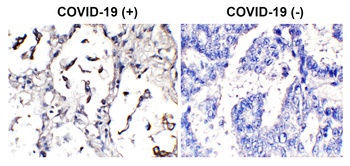 SARS-CoV-2 (COVID-19) Spike Antibody (HRP)