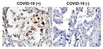 SARS-CoV-2 (COVID-19) Spike Antibody (biotin)