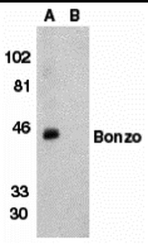 CXCR6 Antibody