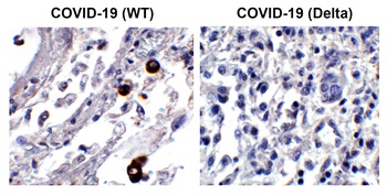 SARS-CoV-2 (COVID-19) Spike 156-157EF Antibody