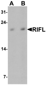 C19orf80 Antibody