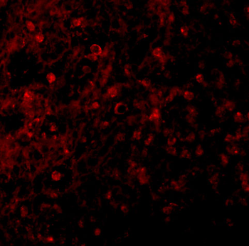 TNFRSF17 Antibody