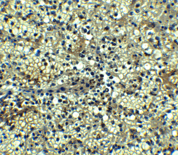 TNFRSF17 Antibody