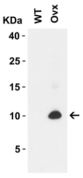 SARS-CoV-2 (COVID-19) ORF9c Antibody