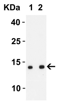 SARS-CoV-2 (COVID-19) ORF8 Antibody