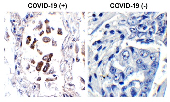 SARS-CoV-2 (COVID-19) ORF8 Antibody