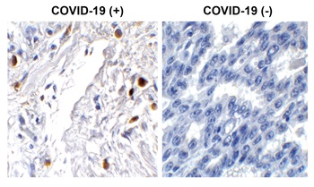 SARS-CoV-2 (COVID-19) ORF7a Antibody