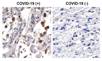 ORF3b Antibody