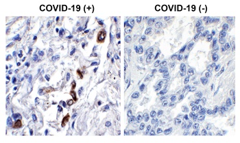 ORF3a Antibody