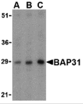 BCAP31 Antibody