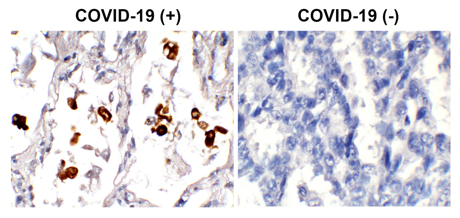 SARS-CoV-2 (COVID-19) Nucleocapsid Antibody (biotin)