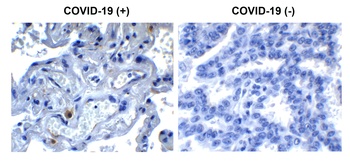 Non-structural protein 9 Antibody