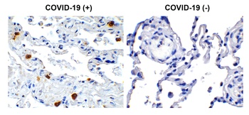 SARS-CoV-2 (COVID-19) NSP8 Antibody