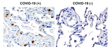 Non-structural protein 8 Antibody