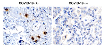 Non-structural protein 7 Antibody