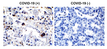 SARS-CoV-2 (COVID-19) 3CL-PRO (NSP5) Antibody