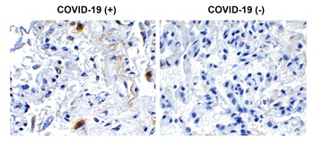 Non-structural protein 2 Antibody