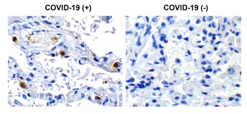 NSP16 Antibody