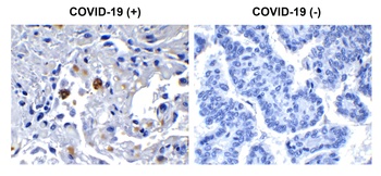 SARS-CoV-2 (COVID-19) NSP13 (Helicase) Antibody