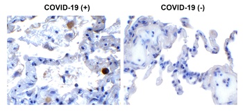 SARS-CoV-2 (COVID-19) NSP13 (Helicase) Antibody