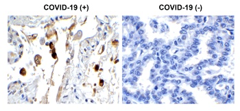 SARS-CoV-2 (COVID-19) Membrane Antibody