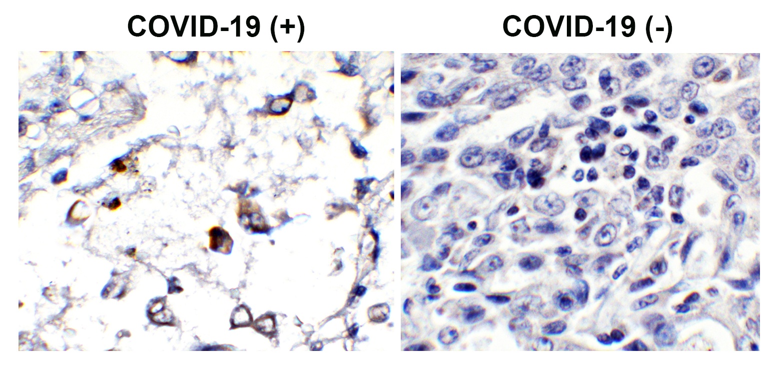 SARS-CoV-2 (COVID-19) Membrane Antibody (HRP)