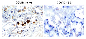 SARS-CoV-2 (COVID-19) Membrane Antibody