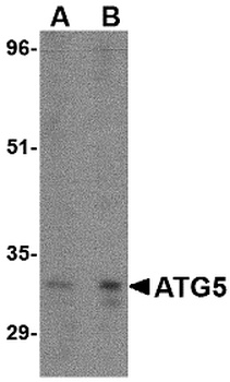 ATG5 Antibody