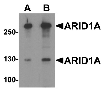 ARID1A Antibody