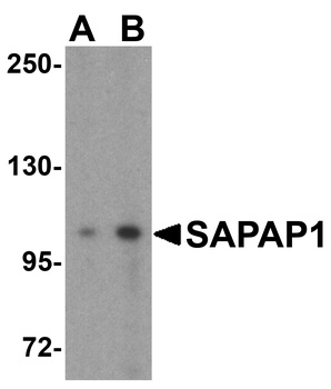 DLGAP1 Antibody