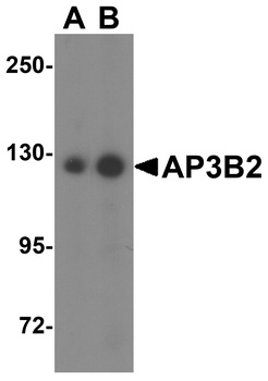 AP3B2 Antibody