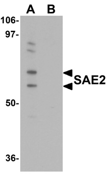 UBA2 Antibody