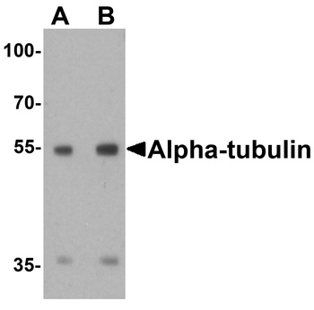 TUBA1A Antibody
