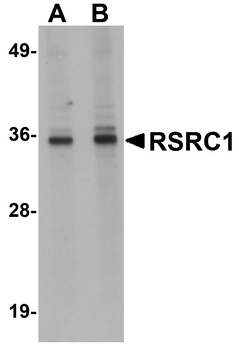 RSRC1 Antibody