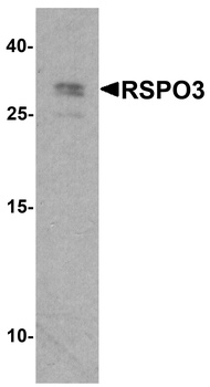 RSPO3 Antibody