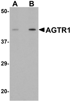 AGTR1 Antibody