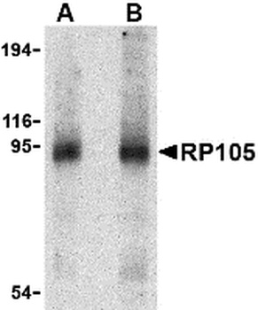 CD180 Antibody