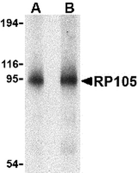 CD180 Antibody