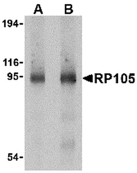 CD180 Antibody