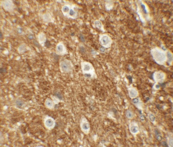 ROCK2 Antibody