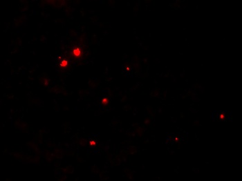 RNASET2 Antibody